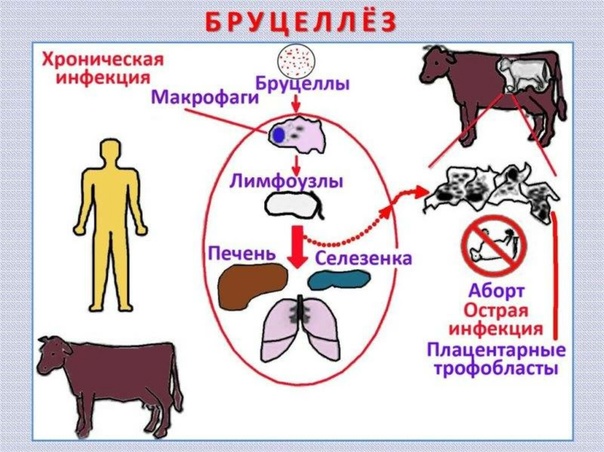 Внимание !! Бруцеллез!! Внимание !! Бруцеллез!!.